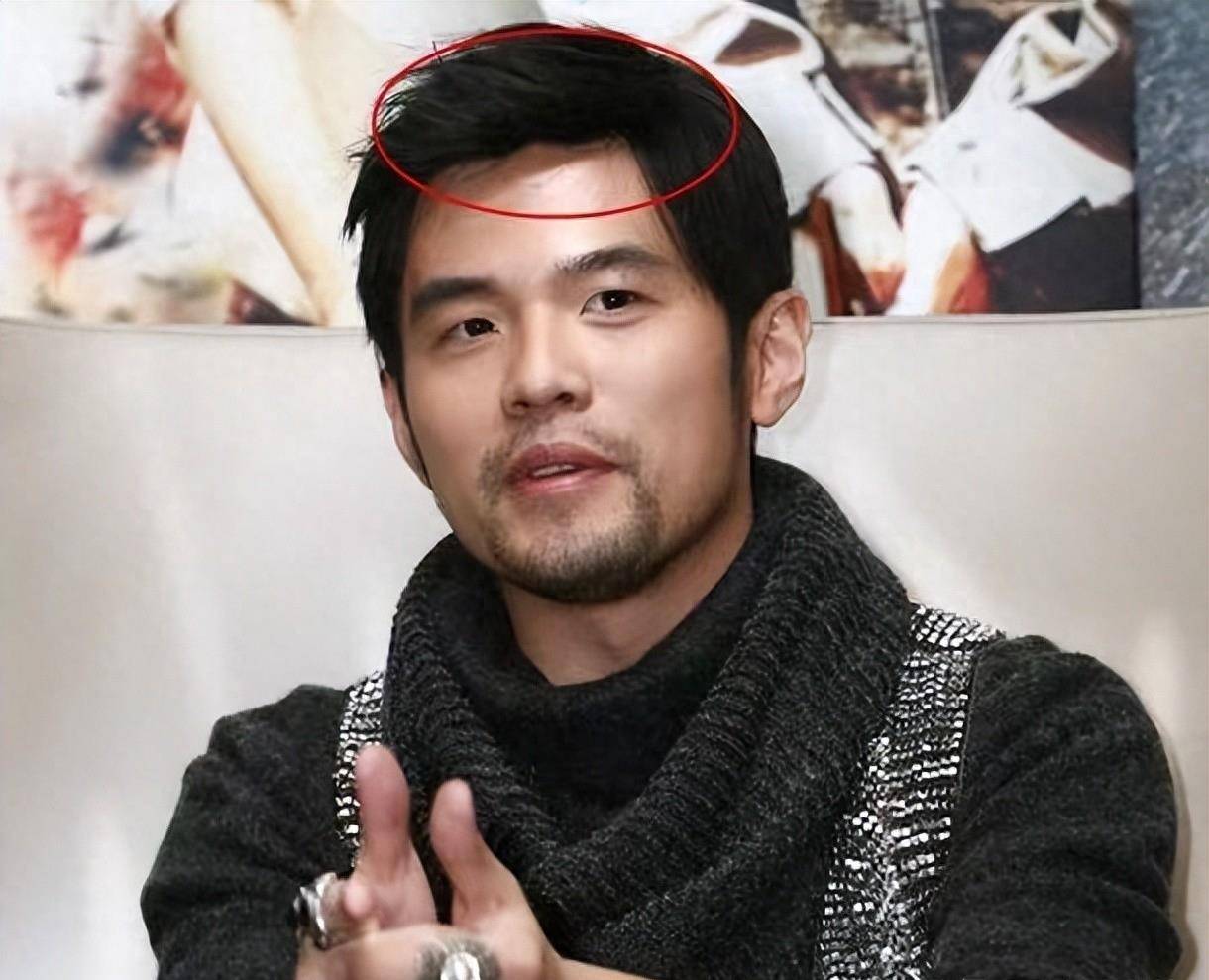 明星戴假发的秘密藏不住了!