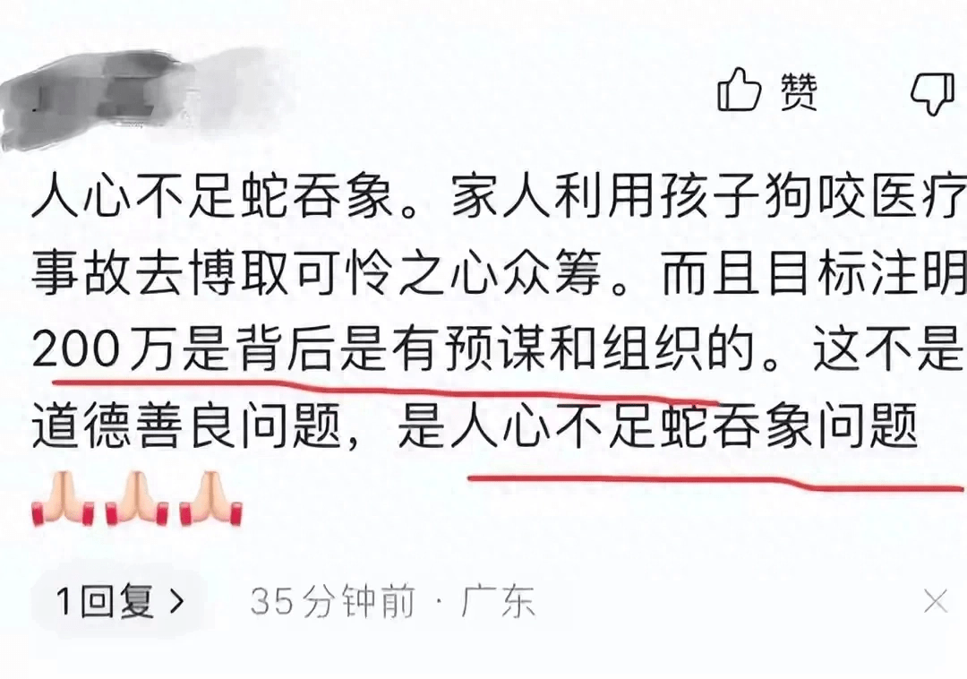 成都2岁女童被咬新后续，狗主人两栋别墅养了4条，知情人透露真相