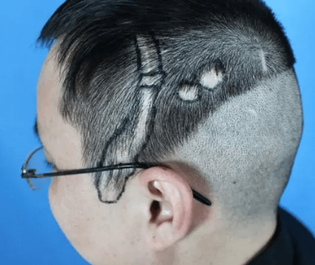 黑米3d纹发:头上有疤痕,最好的解决方案是纹发!