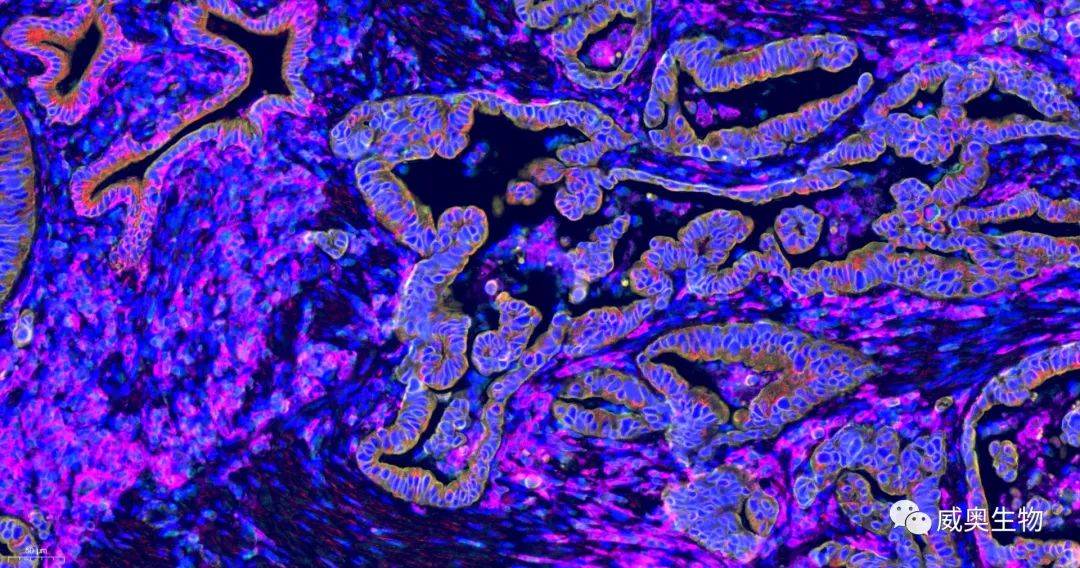 上海威奥丨组织多色免疫荧光(ihc)_染色_标记_进行