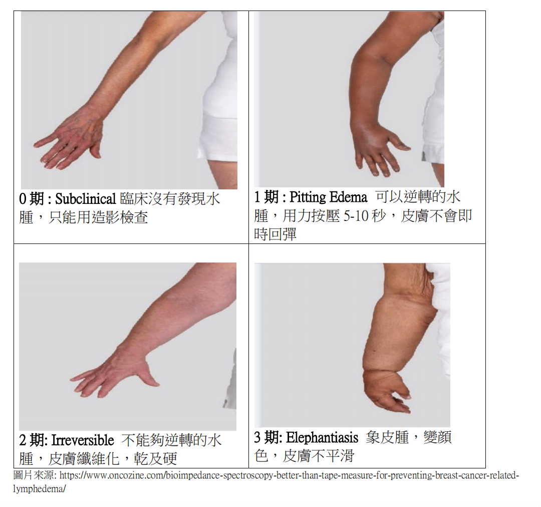 壁虎健康:乳腺癌手术后淋巴水肿,该"肿"么办?_上肢_患者_护理