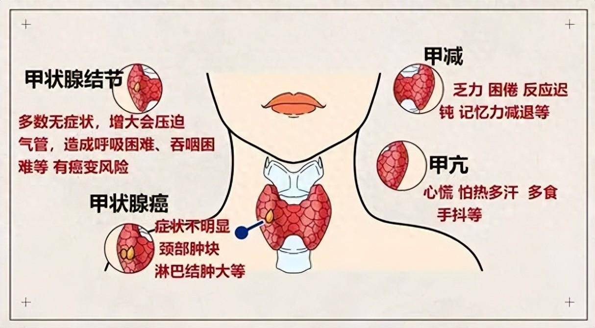 甲状腺位置解剖图图片