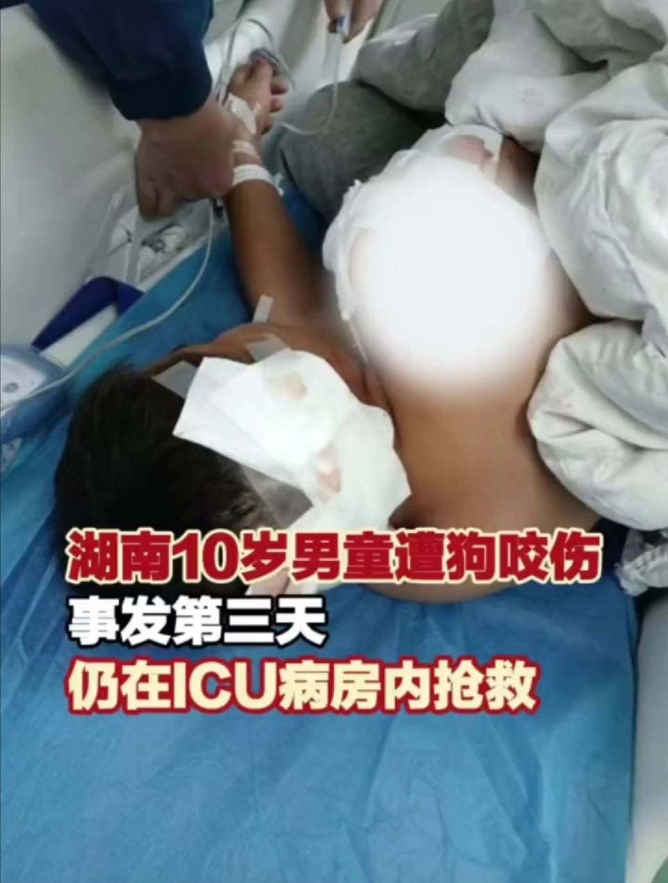 10岁男孩儿遭大型犬咬伤严重,连续三天仍在icu抢救中_丹口镇_孩子