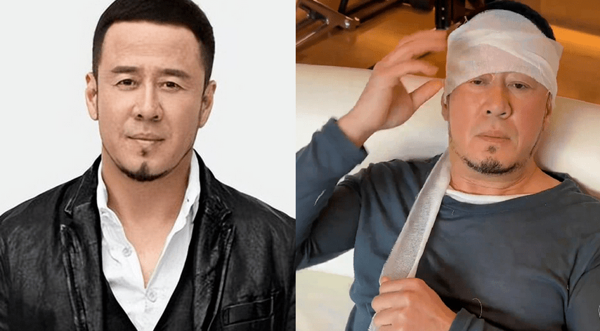 50岁杨坤湖南演出被人胖揍?鼻青脸肿?