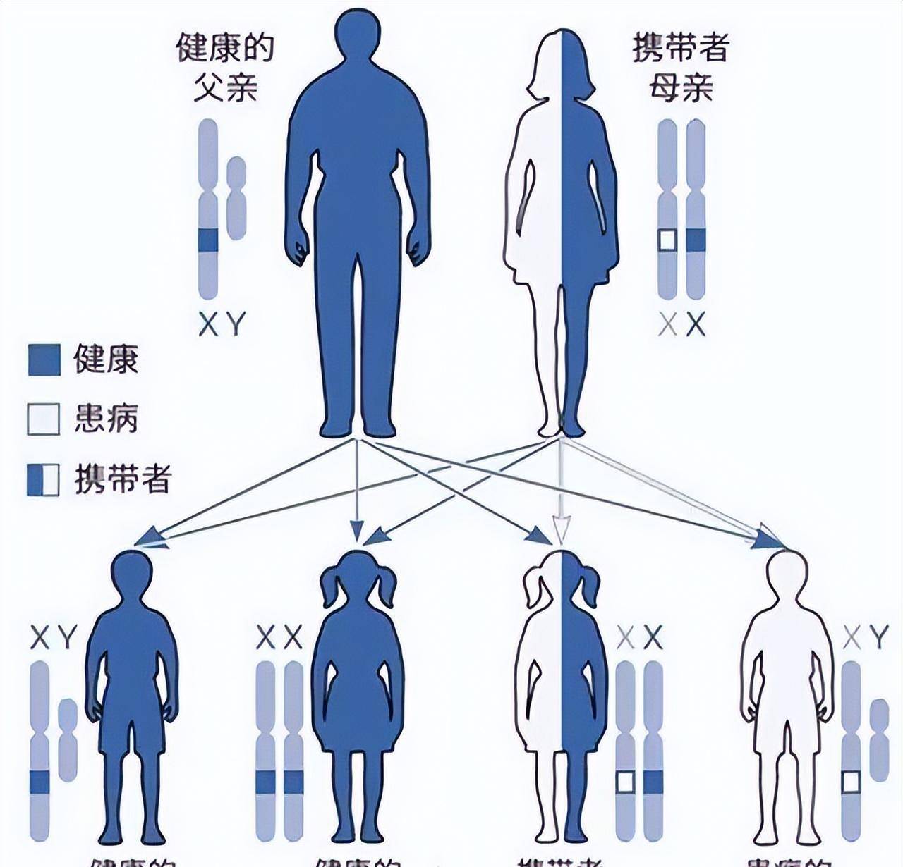 "鸟脸"妈妈执意生二胎,外貌被遗传,智力低下,今靠直播买新房_王小妞