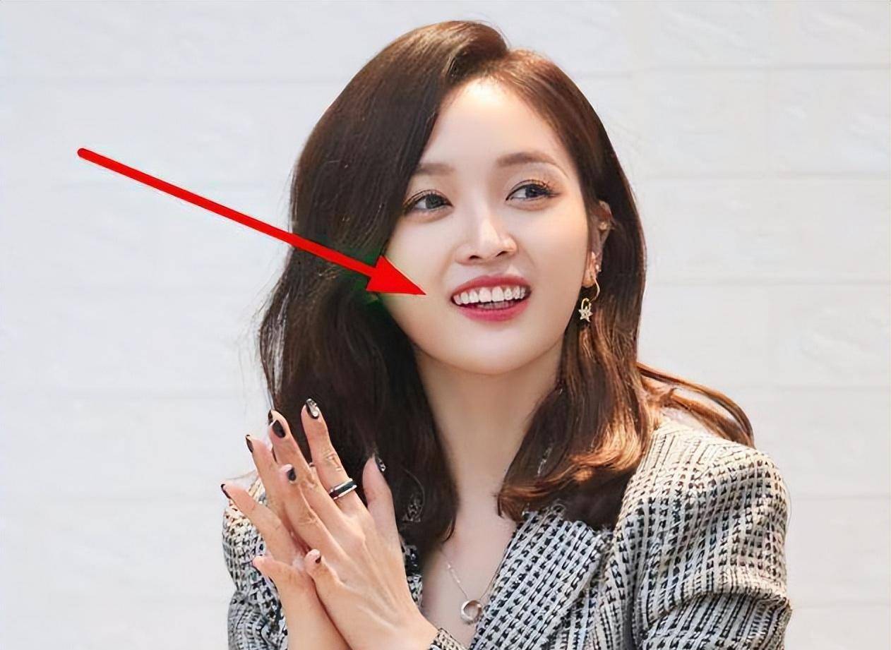 女明星"假牙"大pk,谁的嘴巴闭不上,谁的嘴里藏着一套房?