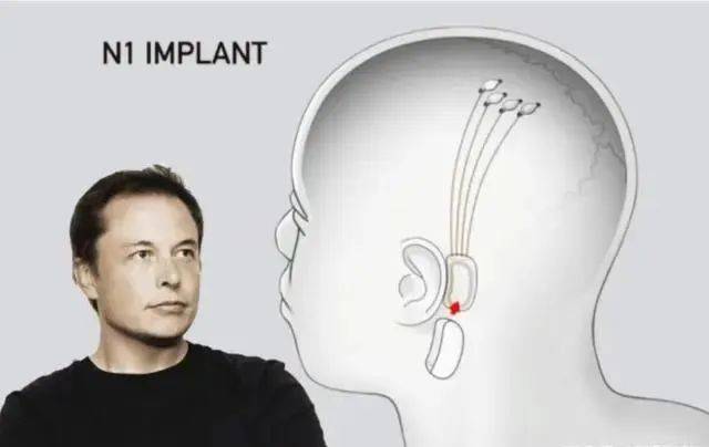 马斯克征召志愿者削除部分头盖骨植入脑机芯片_接口_公司_科技