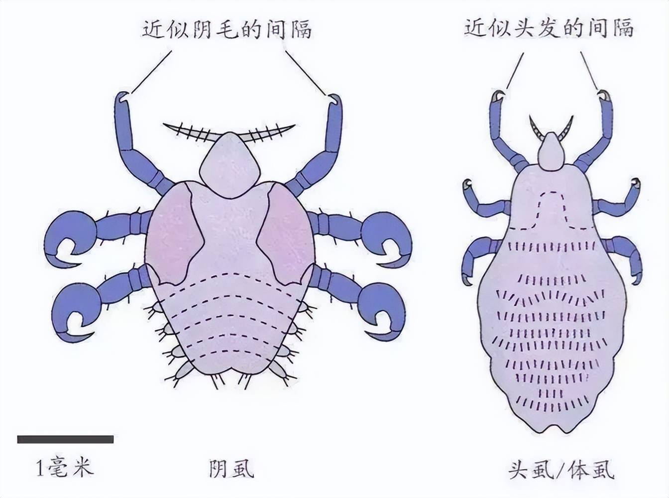 多国罕现床虱爆发!和跳蚤体虱不同,我国消失几十年,又想引入?