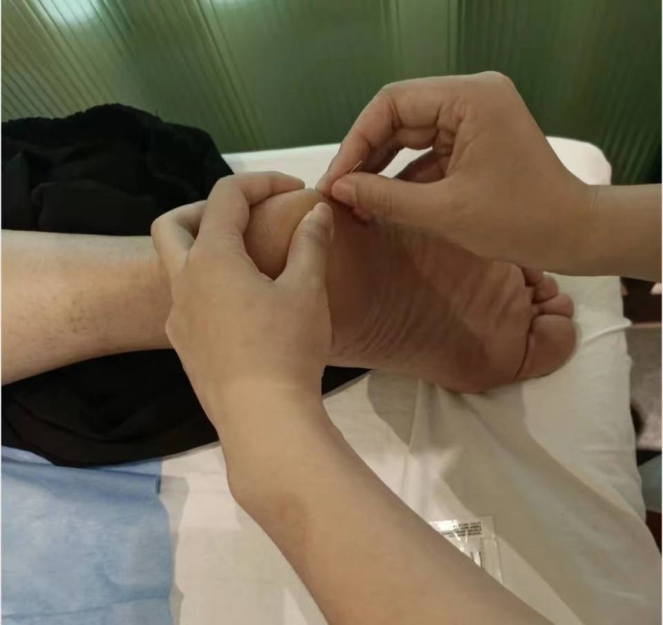 有效消除足底筋膜炎的方法!你一定要看!进来码住!_针灸_yao_足部