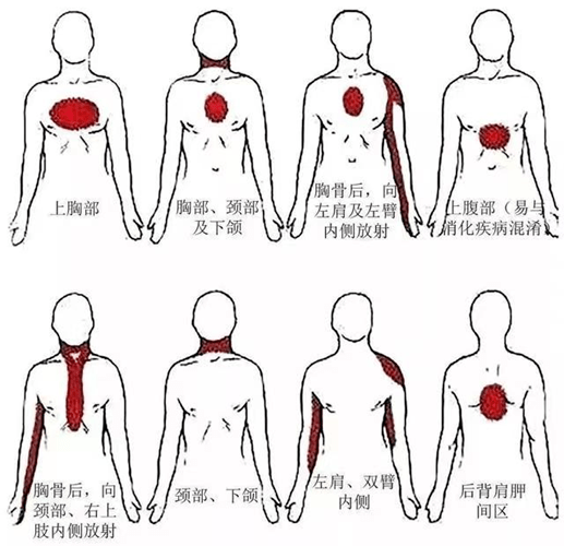 冠状动脉管腔狭窄不严重时