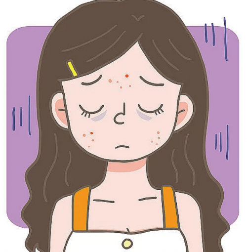 脸上的顽固色斑使用英诺水动力会有效果吗?_肌肤_祛斑_问题