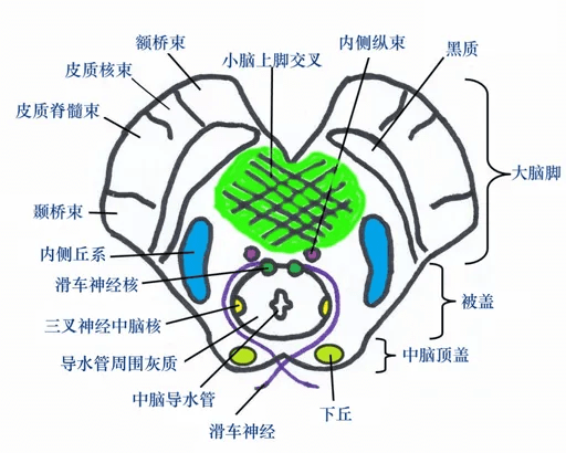 黑质小体图片