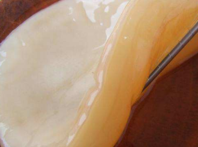 奶奶从醋缸里面捞出一块"大肥肉",本以为不能吃,没想到是个宝_东西