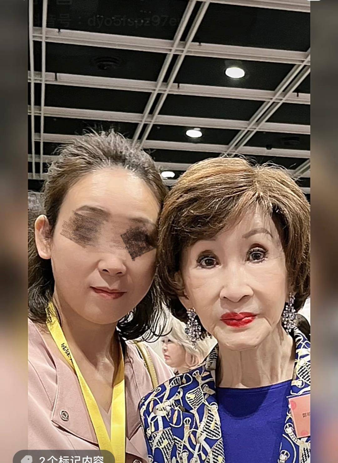 "美容教母"郑明明,77岁过度保养惹争议,脸上没皱纹却显僵硬_女性_印花