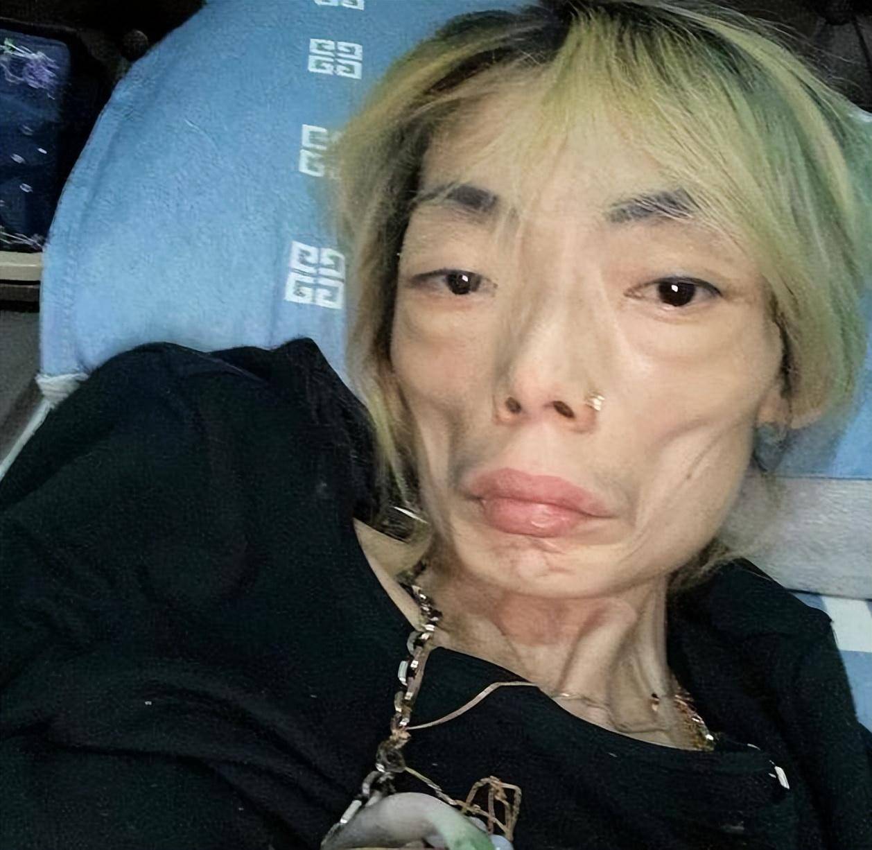 原创嫁给施害者结婚八年瘦到只剩44斤女星伍智恒的结局令人唏嘘