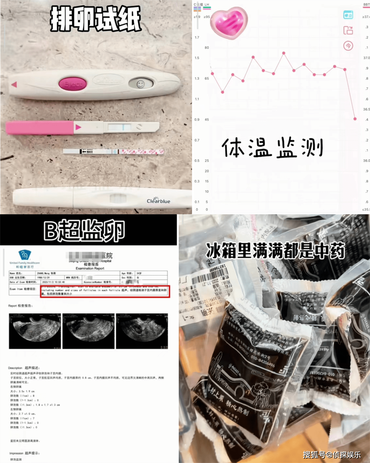 然而在连续喝了11个月的中药,已解决了子宫息肉,且体温试纸,监卵也都