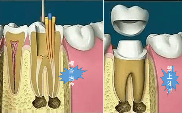 牙齒_口腔_牙刷