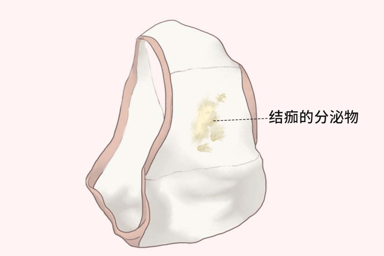 同房不是打仗,别过火:女性同房后出现这5种不适,当