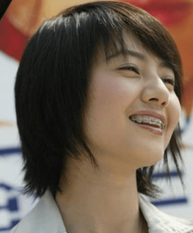 整牙不是病丑起来才要命 盘点杨紫,高圆圆,杨幂……整牙女星