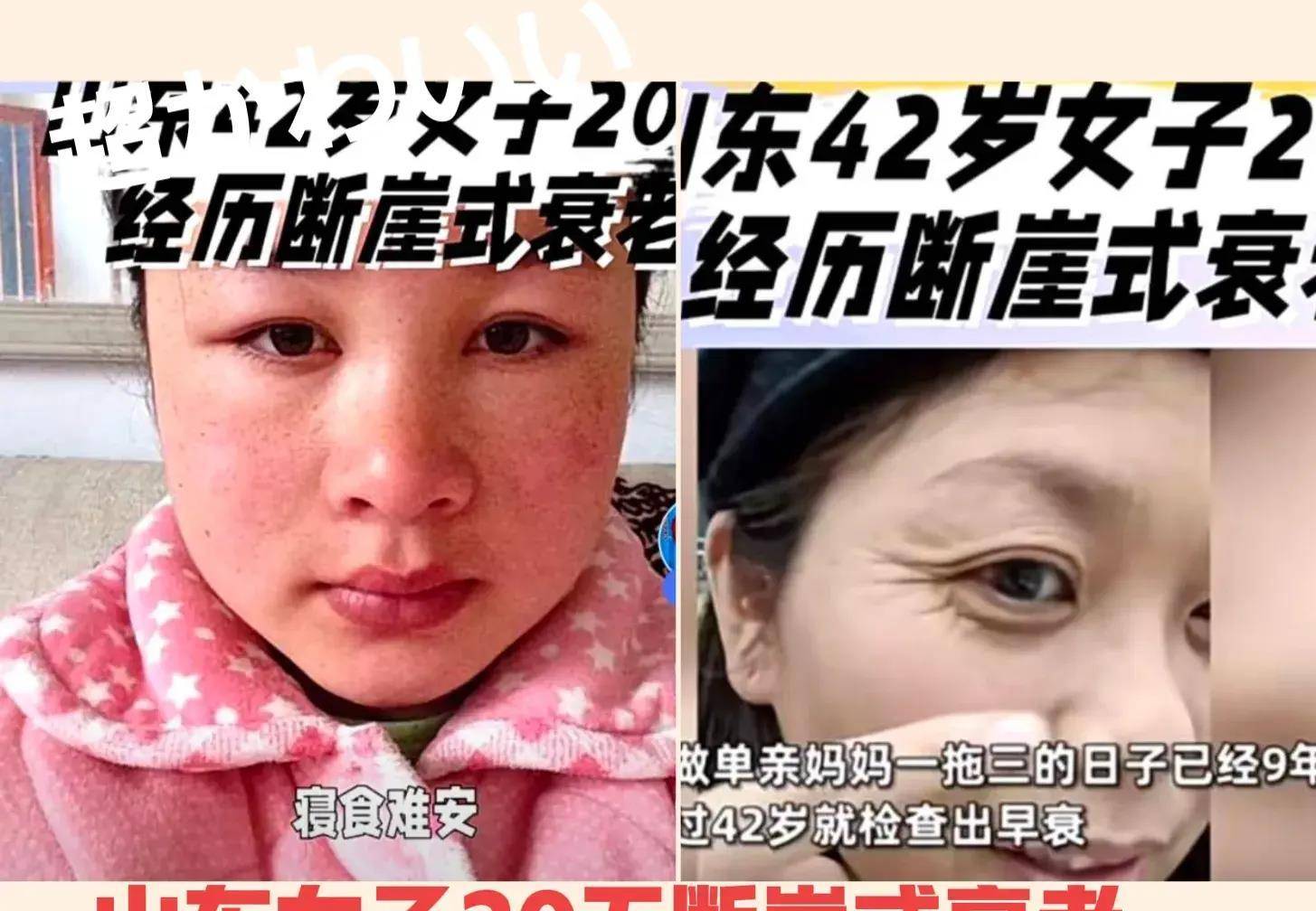 回顧 女子坐月子未滿通宵打工,容貌斷崖式衰老,丈夫