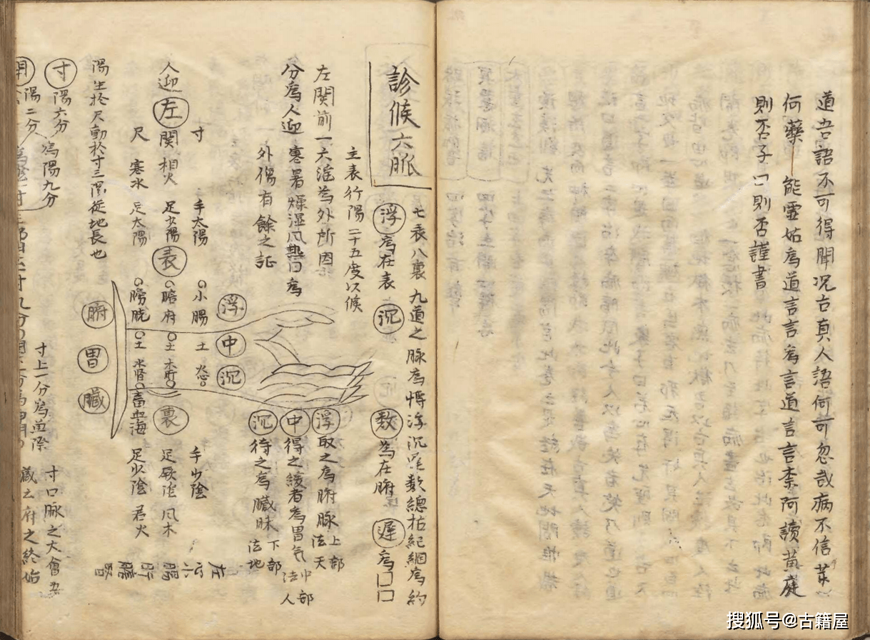 中醫方書《永類鈐方》明清抄本_李仲南_古籍_傷寒