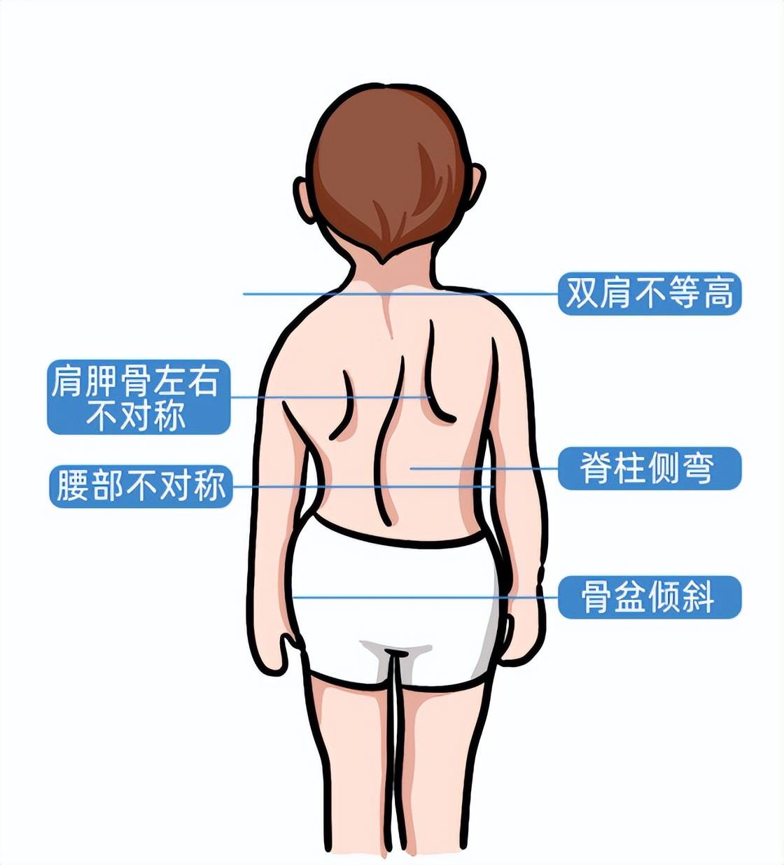 你家小孩做作业时会不会歪来扭去?_脊柱_孩子_漳州