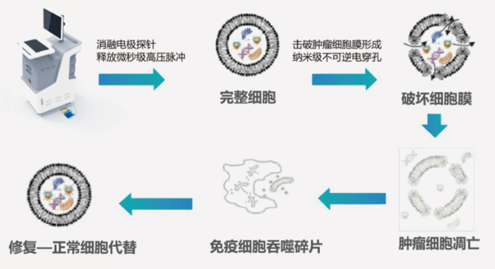 ②納米刀技術的優勢比起其它消融治療,能量更集中,時間更短.