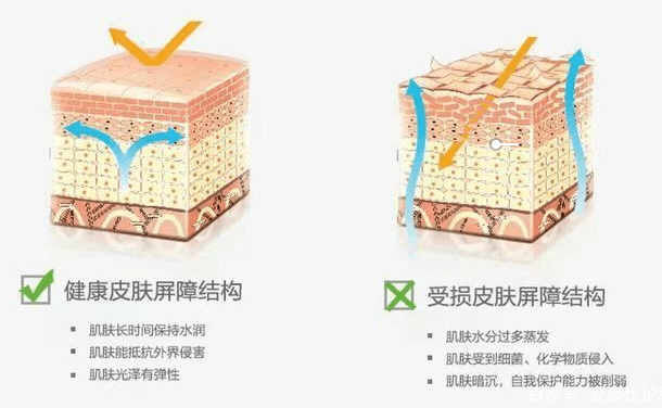 雞皮疙瘩怎麼去除,三招幫你有效改善雞皮膚_角質_尿素