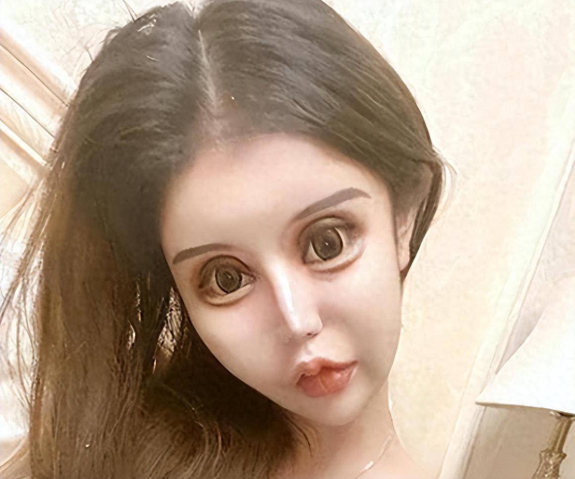 削骨脸上挂不住肉吗_脸削骨_削骨脸上会有疤痕吗