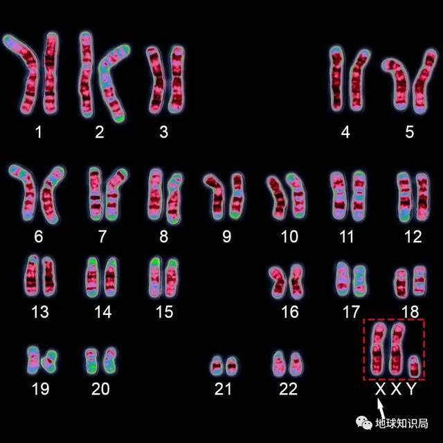 正常男性染色体图片