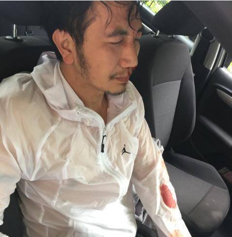 林生斌脖子上套着固定架,躺在病床上,眉骨处有明显