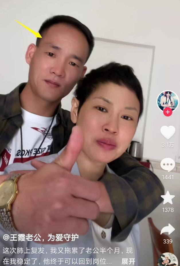 因为照顾妻子,王霞的老公也同样暴瘦不少,当年帅气的小伙子已经变成一