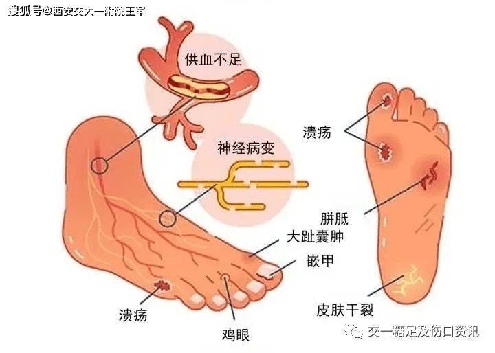 不可忽視的 