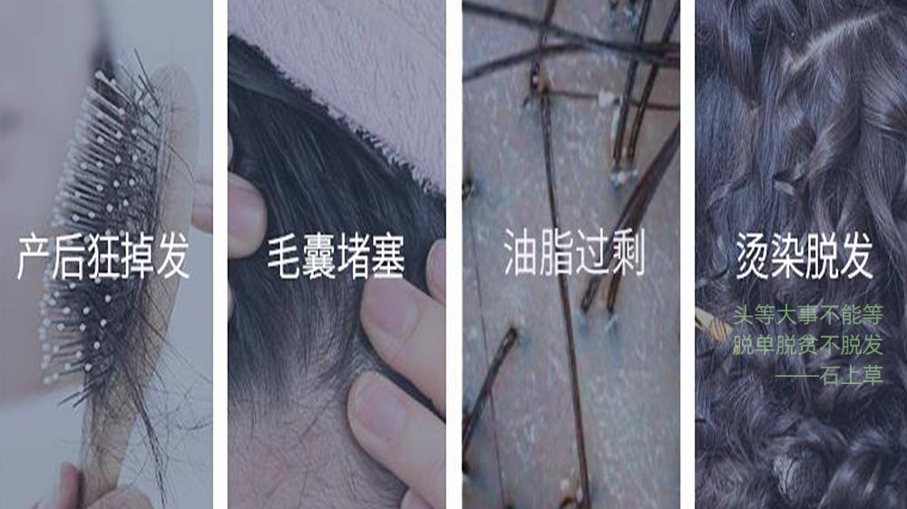 国货之光防脱洗发水_头发_产品_头皮