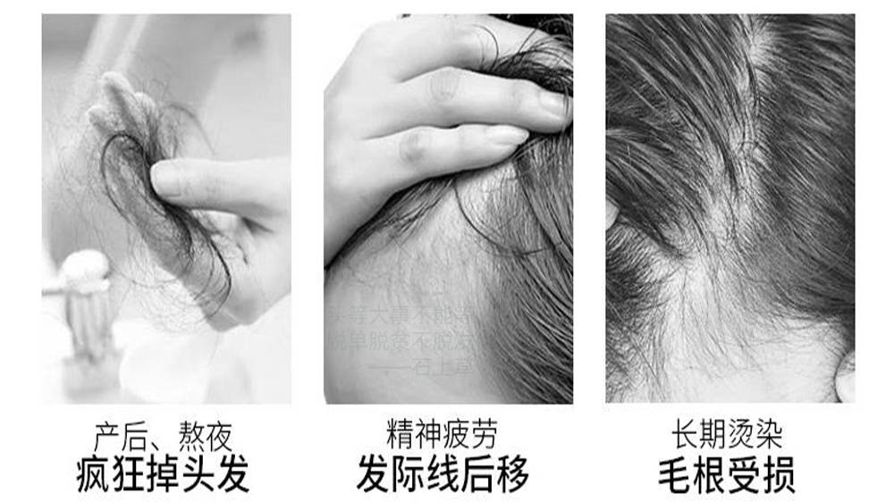 这款防脱洗发水真的好_其效果_头发