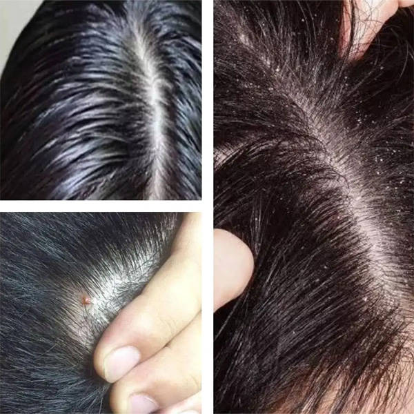 哪个儿童去屑洗发水最受欢迎看看排行榜前十名