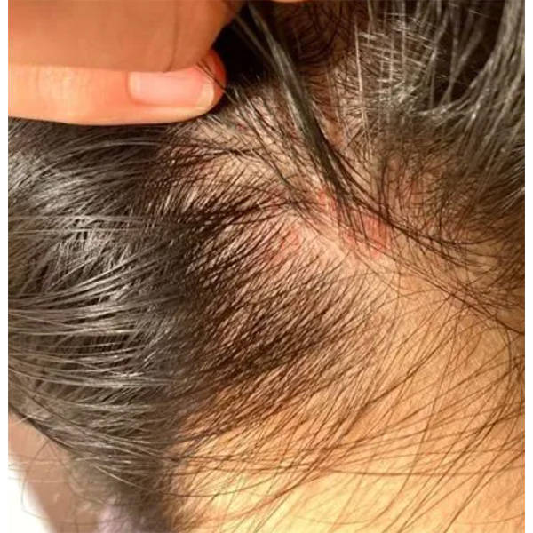 哪些洗发水去头屑?控油止痒的洗发水排行榜