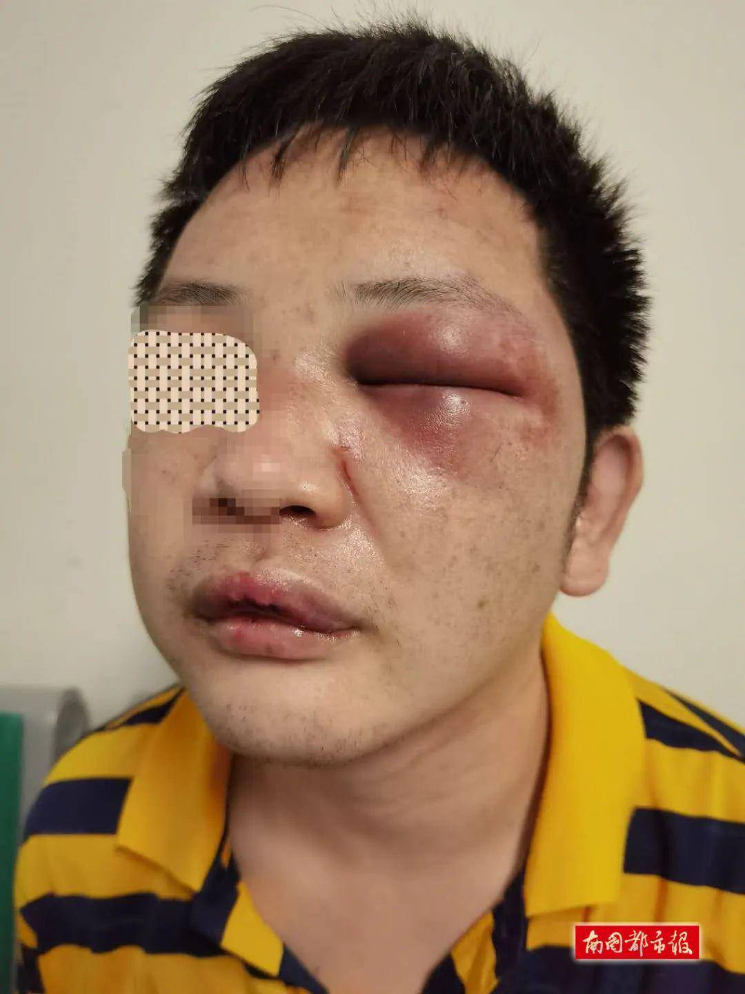 被4男2女围殴近8分钟!海口一保安全身多处挫伤,疑因5元停车费起纠纷