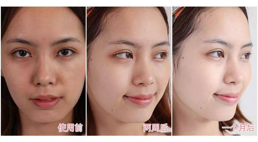 肌肤变紧致了,脸视觉上小了一圈.