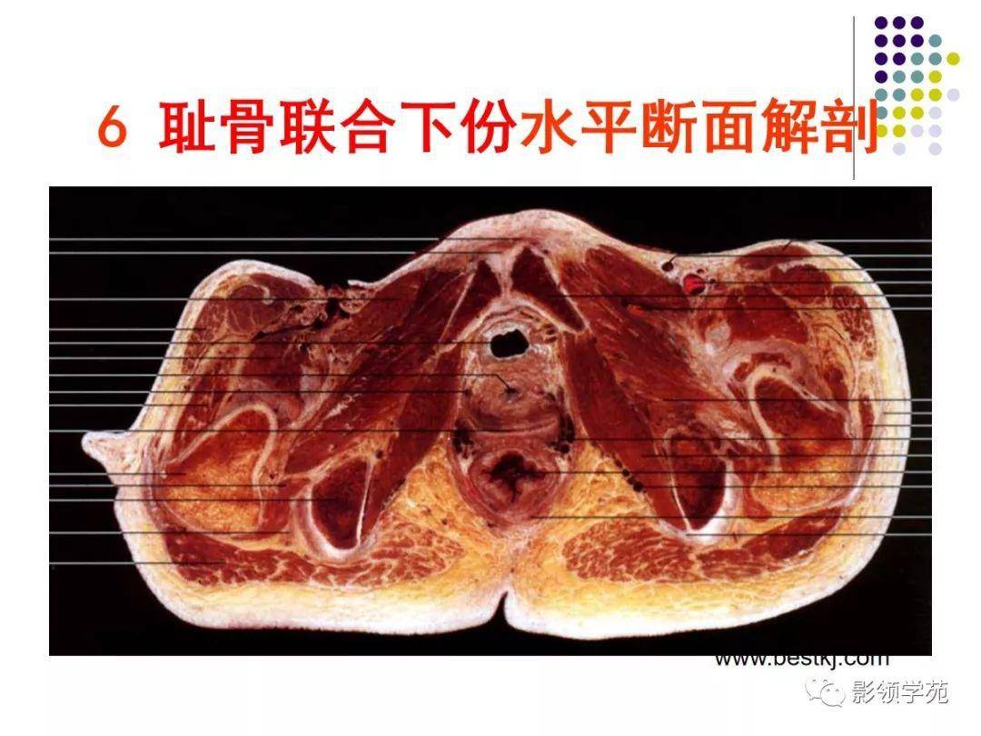 女性盆腔水平断面解剖