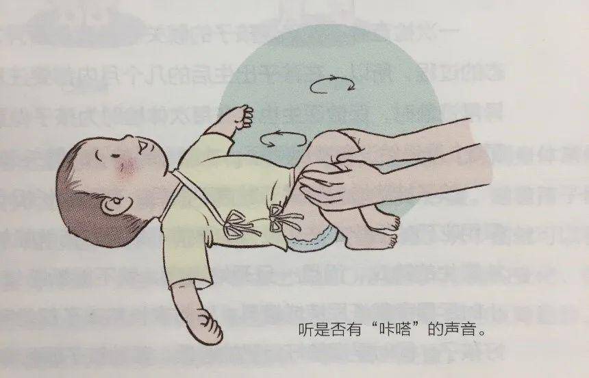 寶寶腿紋不對稱,是怎麼回事兒?