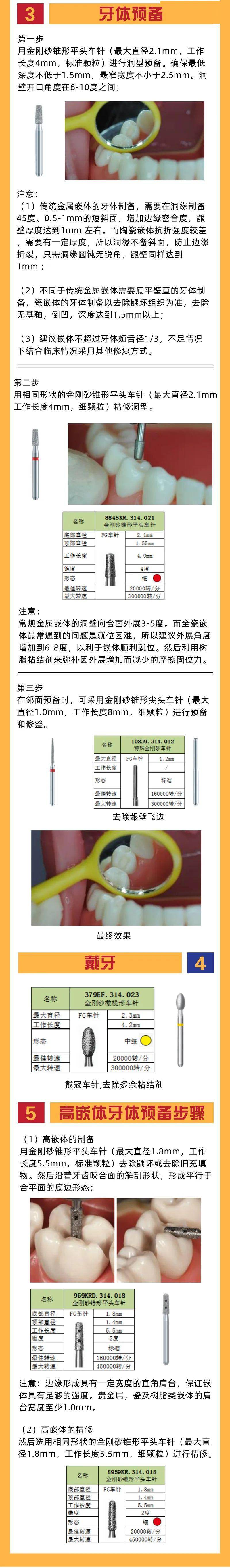 瓷嵌体牙体如何预备?