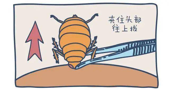 正确的做法是先用酒精,凡士林涂在寄生部位,让蜱虫窒息,之后夹住蜱虫