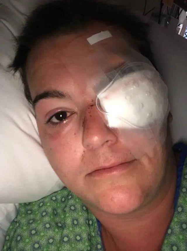 美国女记者被警察用橡皮子弹射爆眼球在混乱中举起双手大声求饶