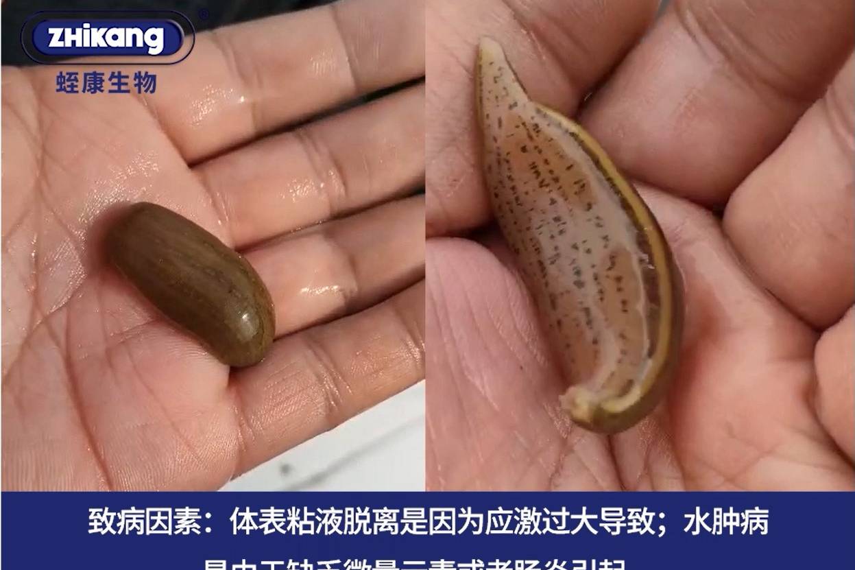 水蛭水肿病的常见症状,致病因素以及应对措施_致病_症状_水蛭