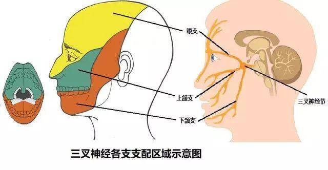 治三叉神經疼手術大概多少錢三叉神經痛的手術費用解析