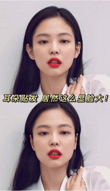 耳朵太贴脑袋,也就是我们常说的贴发耳,也就是耳朵与颅骨之间夹角过小