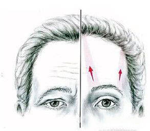 紫洁隐形悬眉术创始人史秋宇院长