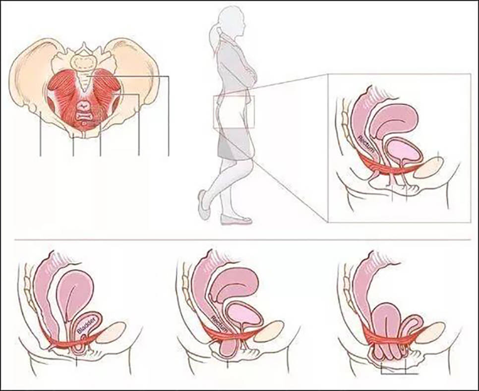 為什麼盆底肌對女性很重要?