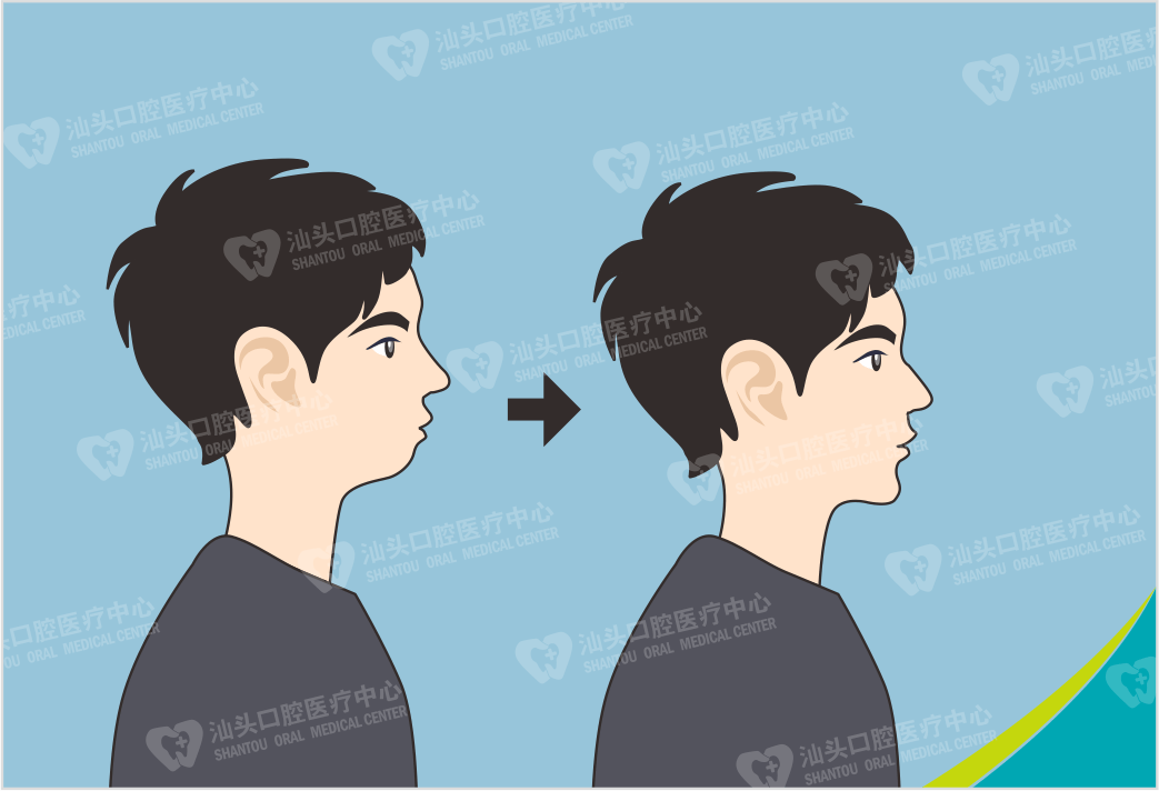 原创
考生戴牙套不能进考场!网友:隐形牙套它不香吗?